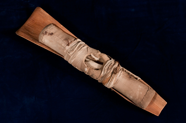 Leg Splint